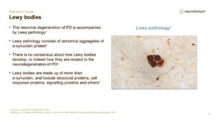 Parkinsons Disease – Neurobiology and Aetiology – slide 9